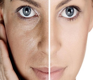 Pores