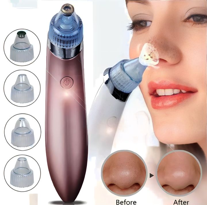 BLACKHEAD SUCKER MACHINE 8620