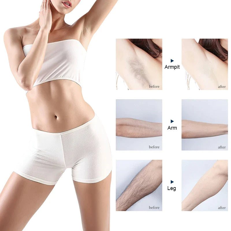 Yardlie Moult 4d Hair Removal Spray