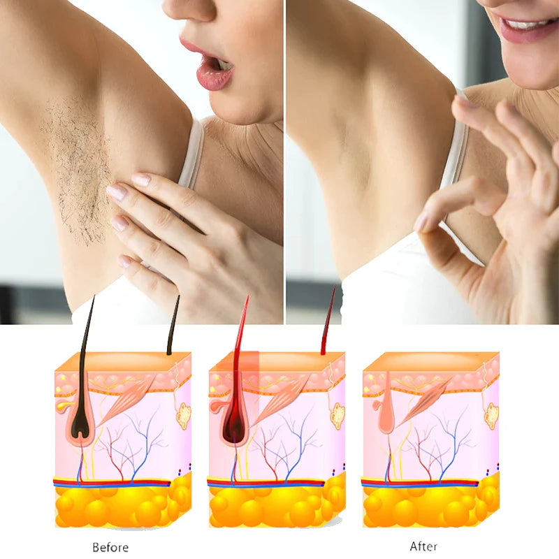 Yardlie Moult 4d Hair Removal Spray