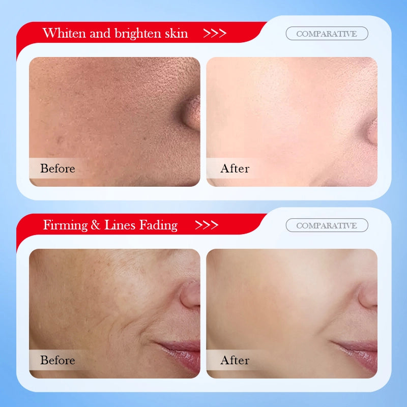 SADOER KOJIC ACID WHITENING FRACKLES FACE SHEET MASK