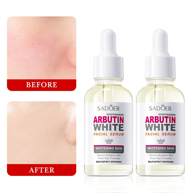 SADOER NICOTINAMIDE ARBUTIN WHITE FACE SERUM