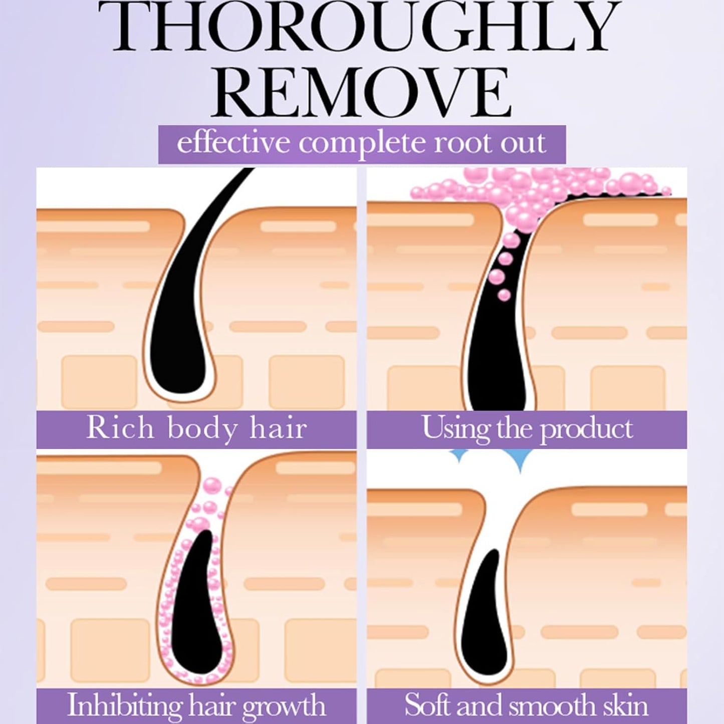SADOER HAIR GROWTH INHIBITION  SPRAY